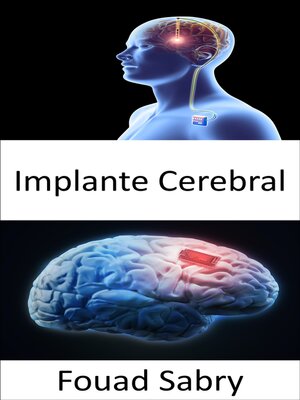 cover image of Implante Cerebral